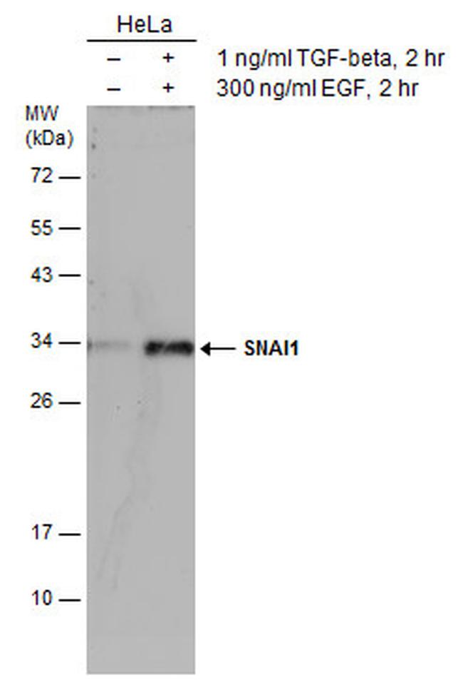 SNAIL Antibody in Western Blot (WB)