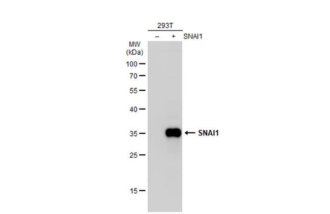 SNAIL Antibody in Western Blot (WB)