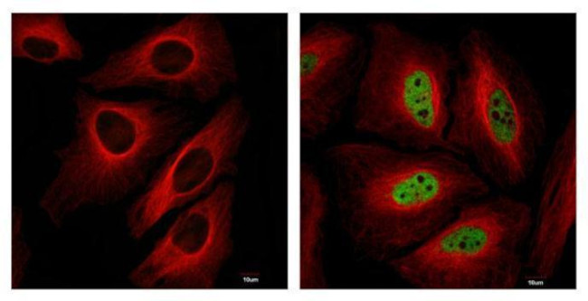 HIF1A Antibody in Immunocytochemistry (ICC/IF)