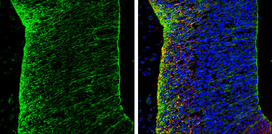 N-cadherin Antibody in Immunohistochemistry (Frozen) (IHC (F))