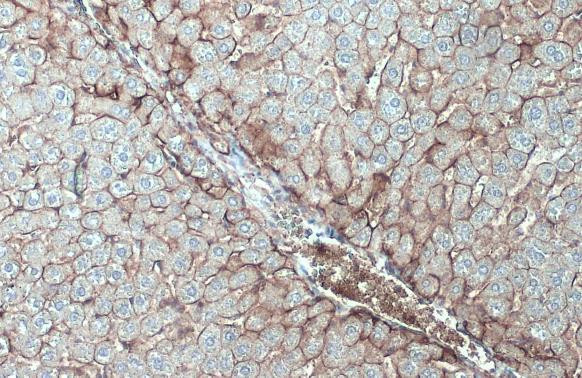 N-cadherin Antibody in Immunohistochemistry (Paraffin) (IHC (P))