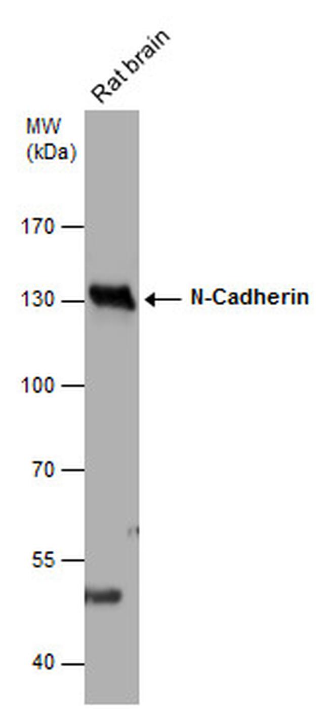 N-cadherin Antibody in Western Blot (WB)