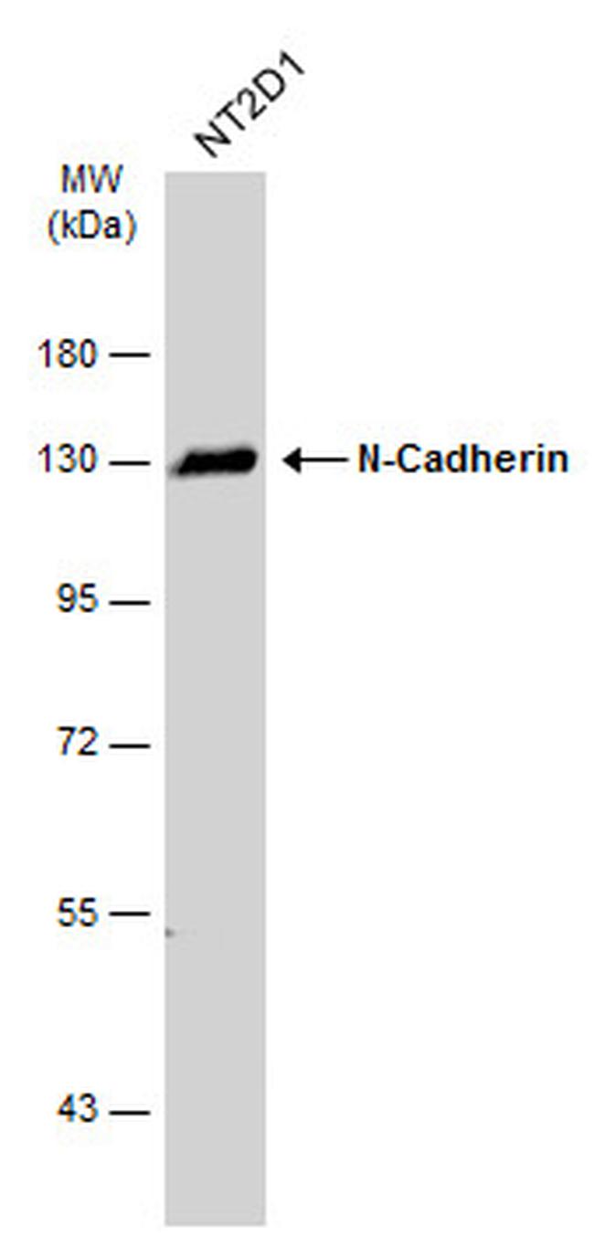 N-cadherin Antibody in Western Blot (WB)