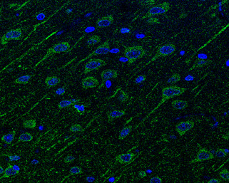 Neuropilin 1 Antibody in Immunohistochemistry (Paraffin) (IHC (P))