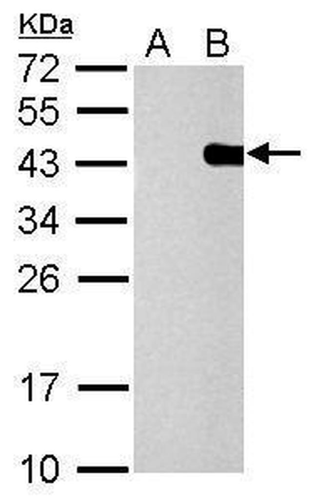 PITX2 Antibody in Western Blot (WB)