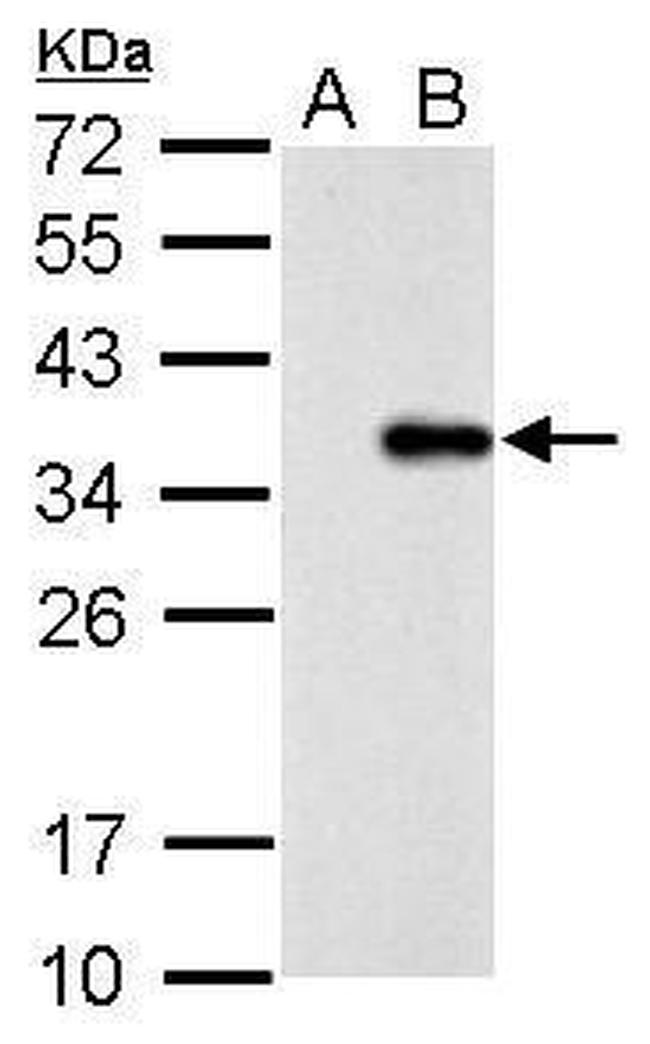 COL11A2 Antibody in Western Blot (WB)