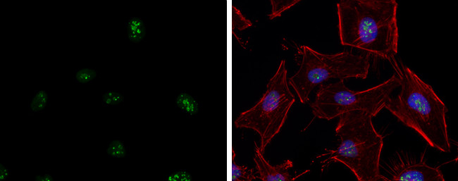 ATR Antibody in Immunocytochemistry (ICC/IF)