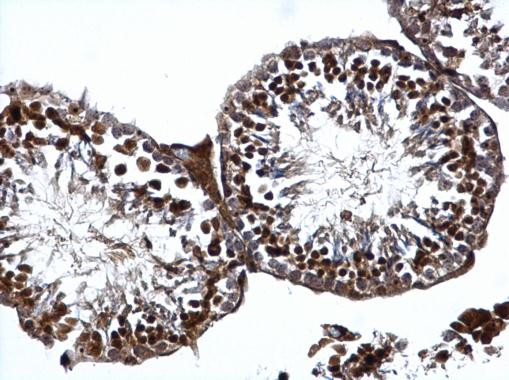 ATR Antibody in Immunohistochemistry (Paraffin) (IHC (P))