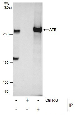 ATR Antibody in Immunoprecipitation (IP)