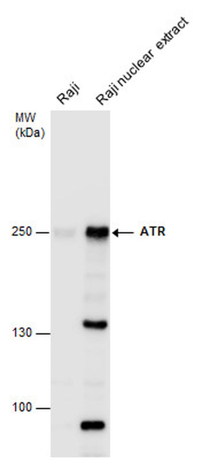 ATR Antibody in Western Blot (WB)