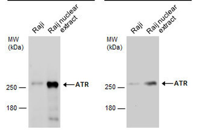 ATR Antibody in Western Blot (WB)