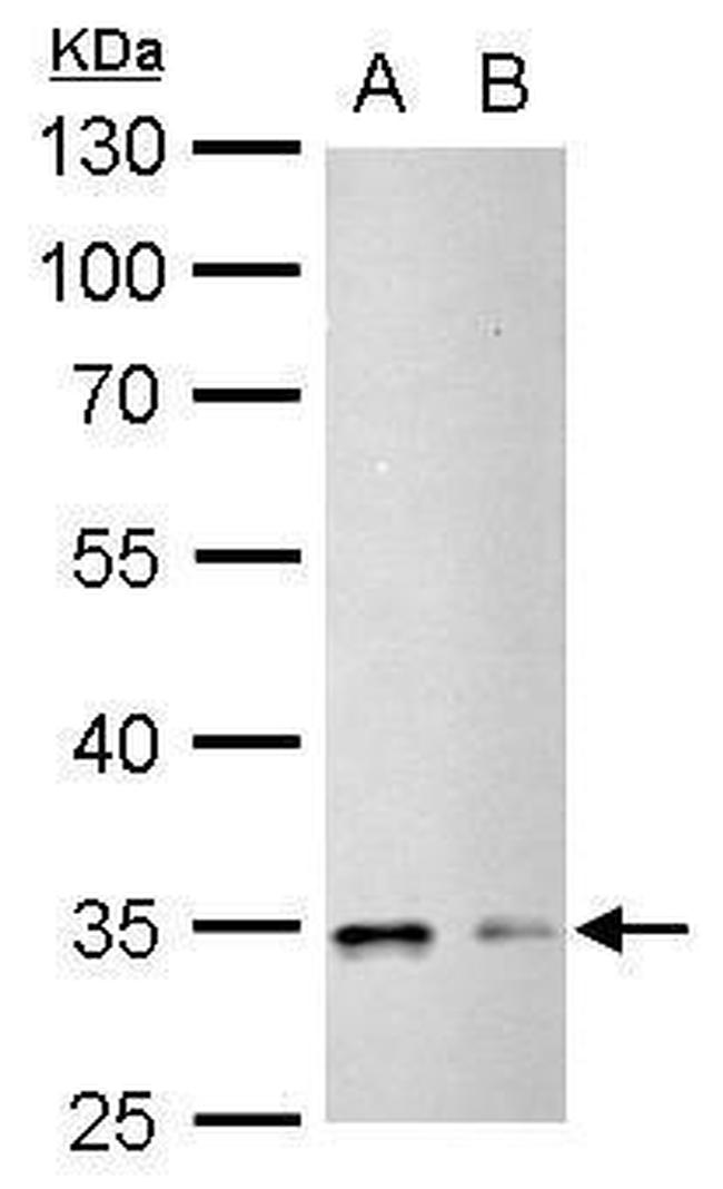 Phospho-CDK1 (Tyr15) Antibody in Western Blot (WB)