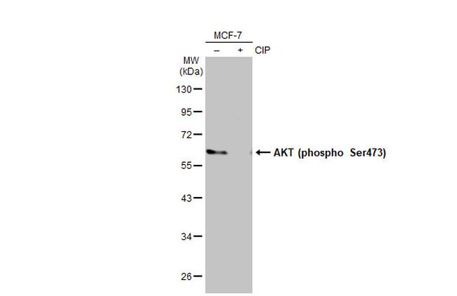 Phospho-AKT1 (Ser473) Antibody in Western Blot (WB)