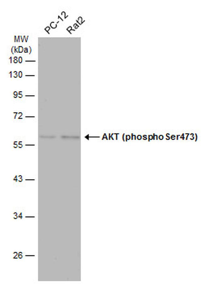 Phospho-AKT1 (Ser473) Antibody in Western Blot (WB)