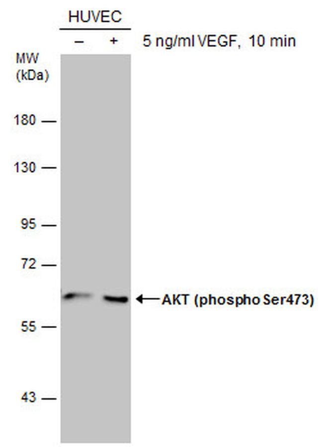 Phospho-AKT1 (Ser473) Antibody in Western Blot (WB)