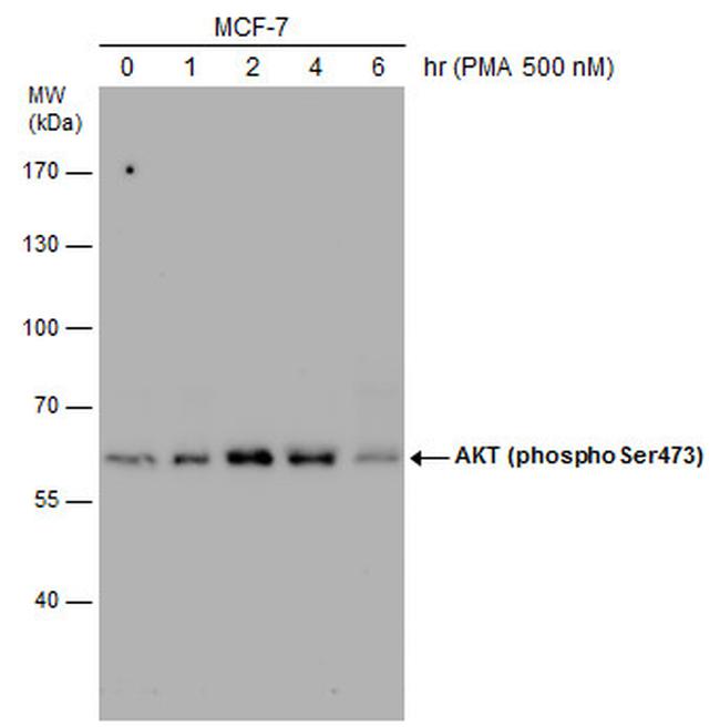 Phospho-AKT1 (Ser473) Antibody in Western Blot (WB)