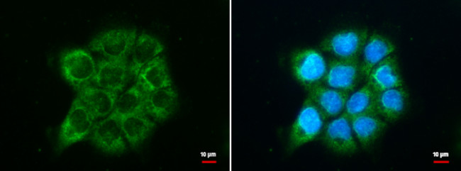 ATG9A Antibody in Immunocytochemistry (ICC/IF)