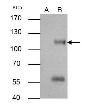 ATG9A Antibody in Immunoprecipitation (IP)