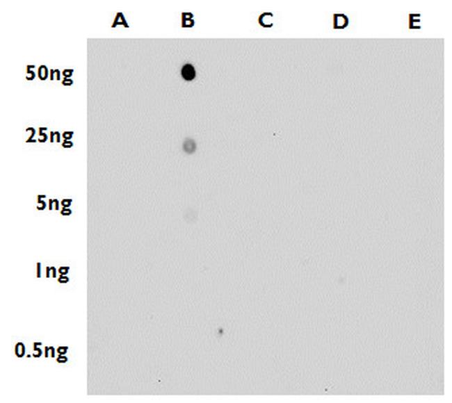 5-Methylcytosine Antibody in Dot Blot (DB)