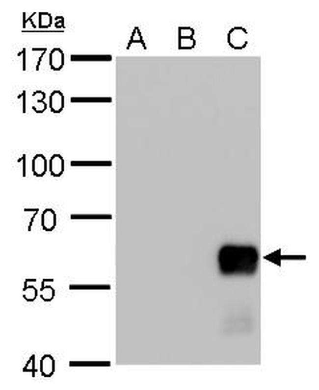 AKT2 Antibody in Western Blot (WB)