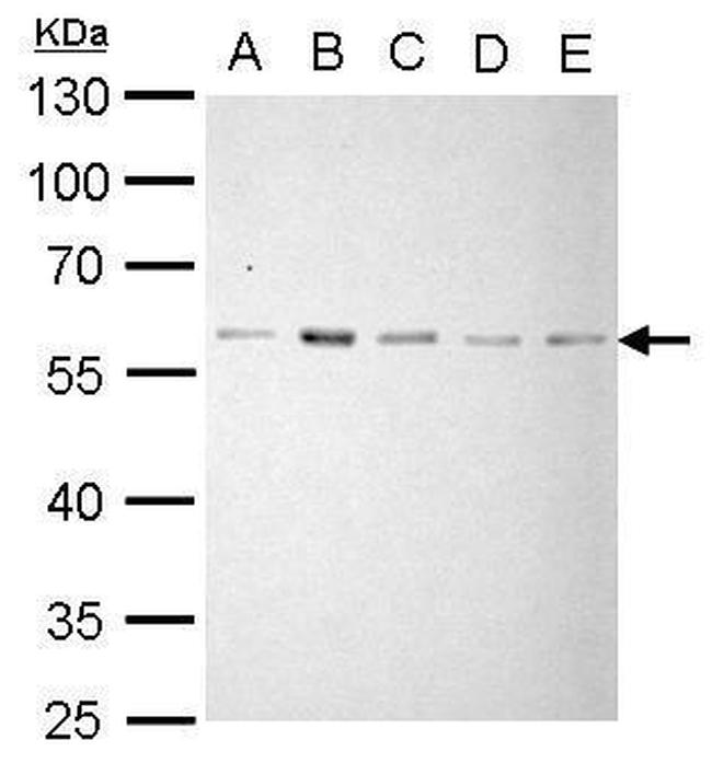 AKT2 Antibody in Western Blot (WB)