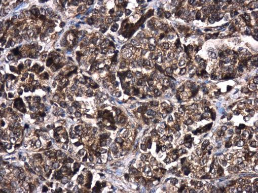 AKT2 Antibody in Immunohistochemistry (Paraffin) (IHC (P))