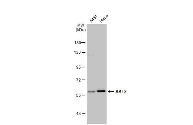 AKT2 Antibody in Western Blot (WB)