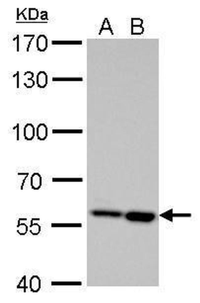 AKT2 Antibody in Western Blot (WB)