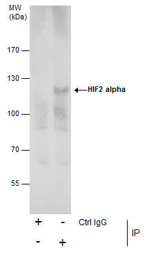 HIF-2 alpha Antibody in Immunoprecipitation (IP)