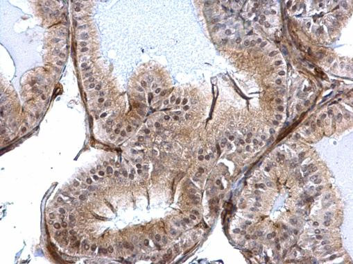 SLUG Antibody in Immunohistochemistry (Paraffin) (IHC (P))