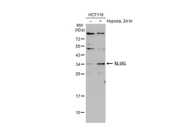 SLUG Antibody in Western Blot (WB)