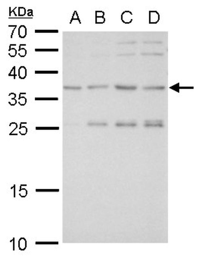 SLUG Antibody in Western Blot (WB)