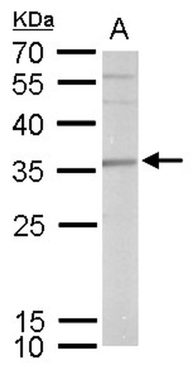 SLUG Antibody in Western Blot (WB)