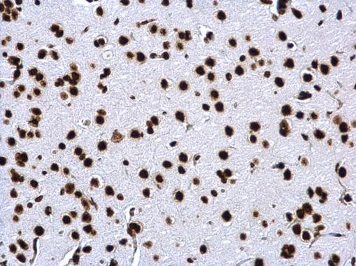 H3K18ac Antibody in Immunohistochemistry (Paraffin) (IHC (P))