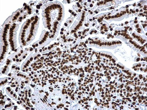 H3K18ac Antibody in Immunohistochemistry (Paraffin) (IHC (P))