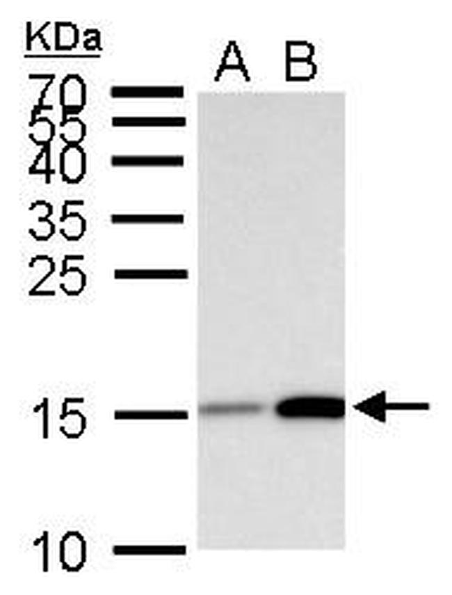 H3K18ac Antibody in Western Blot (WB)