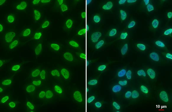 H3K18ac Antibody in Immunocytochemistry (ICC/IF)