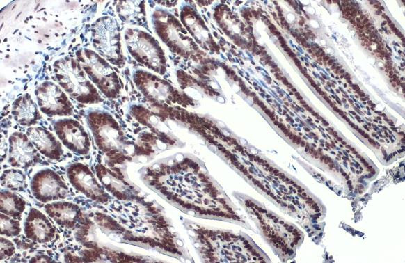 H3K18ac Antibody in Immunohistochemistry (Paraffin) (IHC (P))