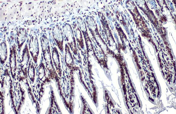 H3K18ac Antibody in Immunohistochemistry (Paraffin) (IHC (P))