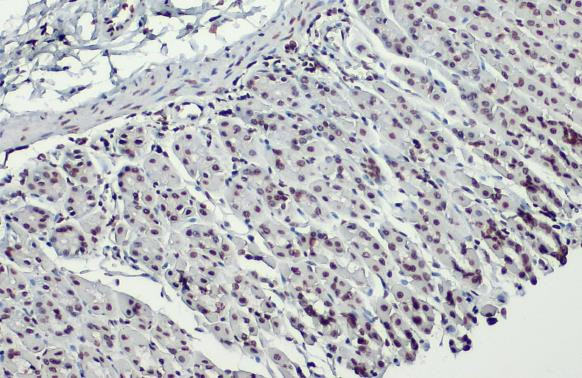 H3K18ac Antibody in Immunohistochemistry (Paraffin) (IHC (P))