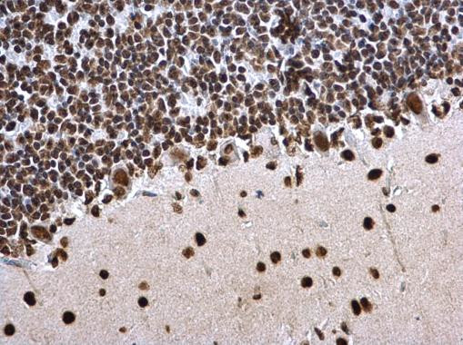 H3K27ac Antibody in Immunohistochemistry (Paraffin) (IHC (P))