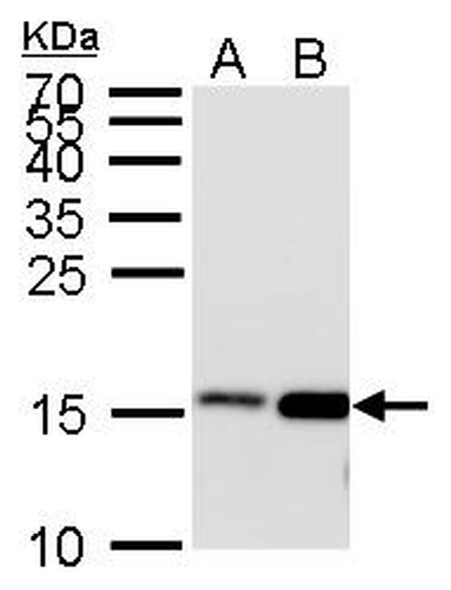 H3K27ac Antibody in Western Blot (WB)