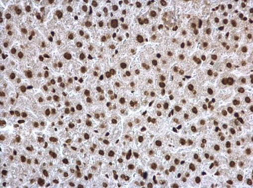 H3K27ac Antibody in Immunohistochemistry (Paraffin) (IHC (P))