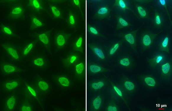 H3K4me3 Antibody in Immunocytochemistry (ICC/IF)