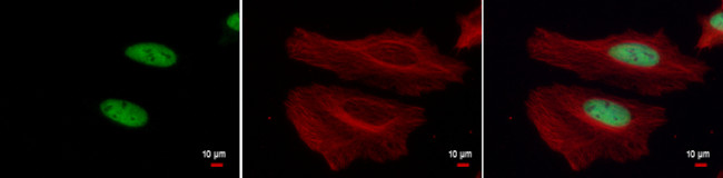 H3K4me3 Antibody in Immunocytochemistry (ICC/IF)