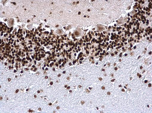 H3K4me3 Antibody in Immunohistochemistry (Paraffin) (IHC (P))