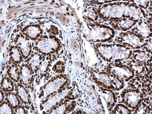 H3K4me3 Antibody in Immunohistochemistry (Paraffin) (IHC (P))