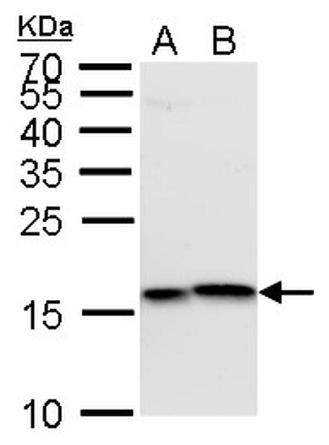 H3K4me3 Antibody in Western Blot (WB)