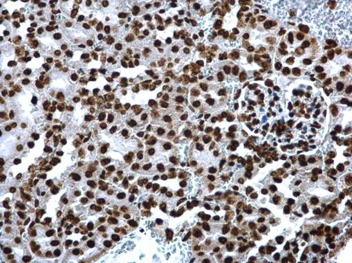 H4K8ac Antibody in Immunohistochemistry (Paraffin) (IHC (P))