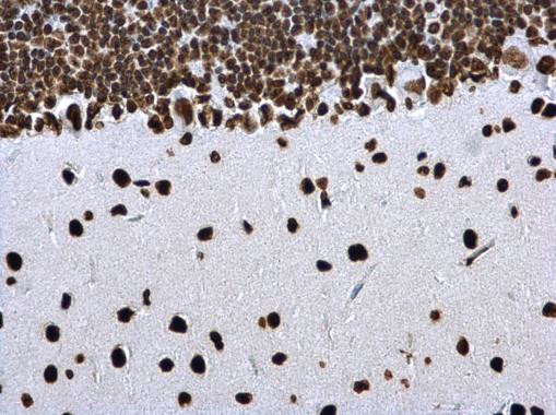 H4K8ac Antibody in Immunohistochemistry (Paraffin) (IHC (P))